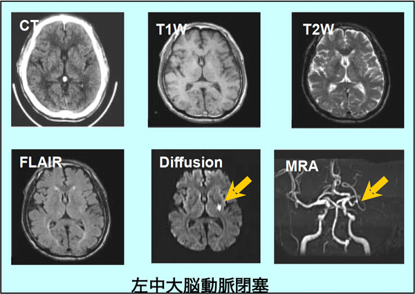MRI検査_2
